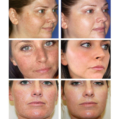 Moisturizing Pore Shrinking Cream