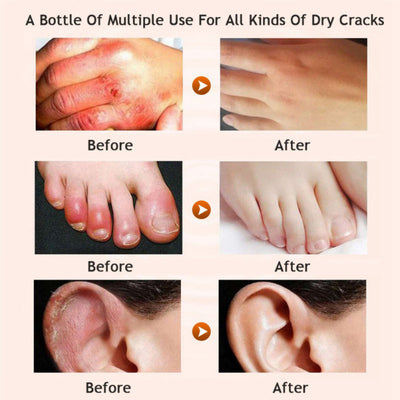 Honey moisturizing foot cream